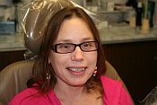 Catonsville Dentist Review
